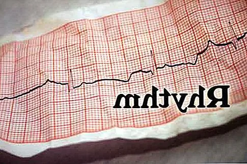 Если бы мы говорили о музыке, мы бы описали ритмы ритма пульса музыки. В дизайне интерьера ритм - это все, что касается повторения визуального шаблона. Ритм определяется как непрерывность, повторяемость или организованное движение. Чтобы достичь этих тем в дизайне, вам нужно подумать о повторении, прогрессии, переходе и контрасте. Использование этих механизмов придаст вашему движению ощущение движения, ведущее взгляд от одного элемента дизайна к другому.