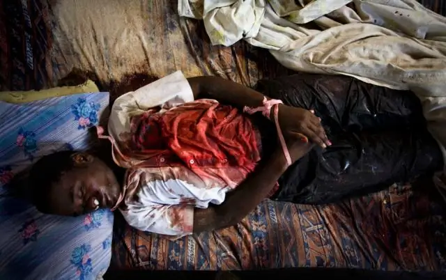 Носимые изделия революционизируют классическую медицину