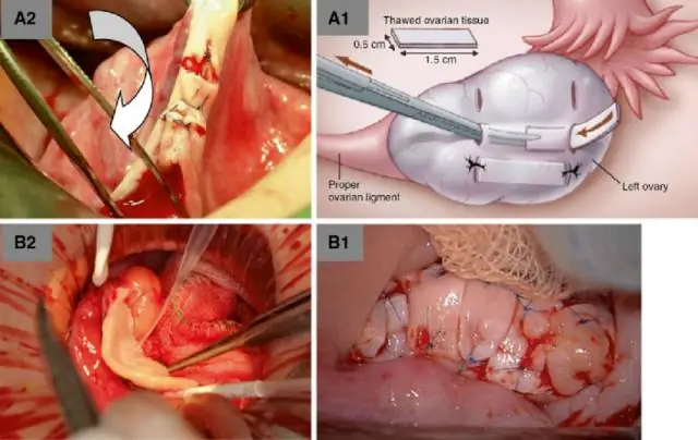 Сделать технологию легкой для понимания